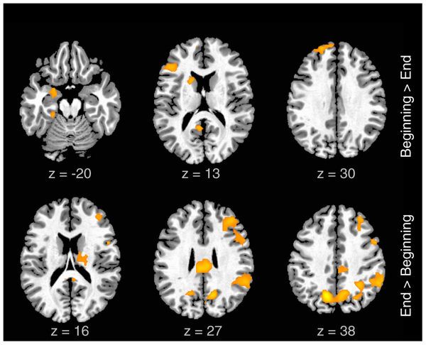 Activations associated with evolution of improvisation in time: Activity selectively related to improvisation at the beginning vs. the end of each 8 bar segment is illustrated.