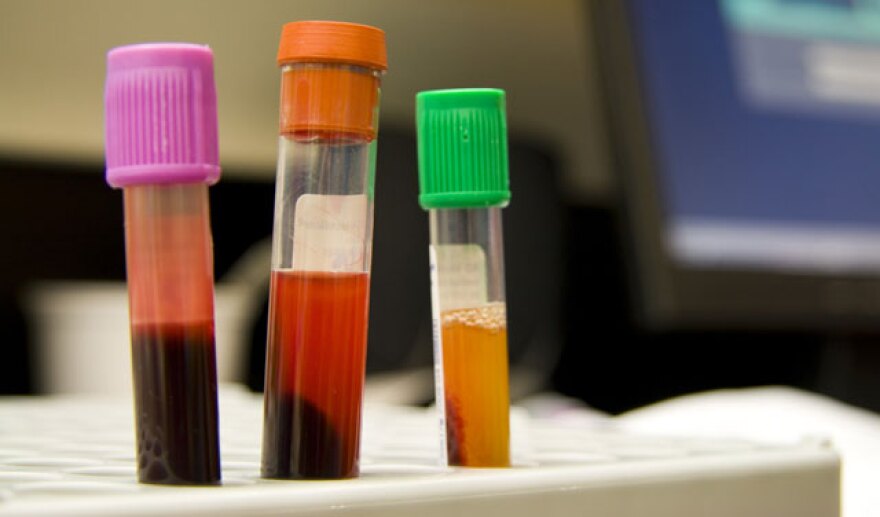 dna_rape_test_backlog2.jpg