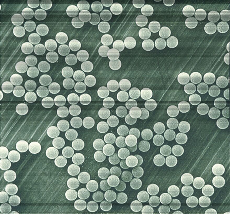 Microscopic view of microbeads. 