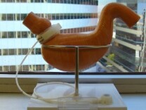 A Lap-Band is displayed on a mock up of a human stomach.