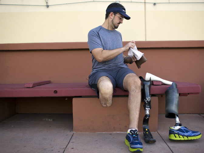 Damian Kevitt, who was struck my a car while biking in Griffith Park on Feb. 17, 2013, will run in the LA Marathon on Sunday, March 15, 2015.
