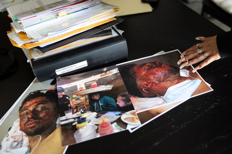 Various images on top of a black table, two of a face beaten and bloodied and the other of a young man smiling at a restaurant wearing a sombrero. A hand with acrylic nails touches one of the images of a bloodied face.
