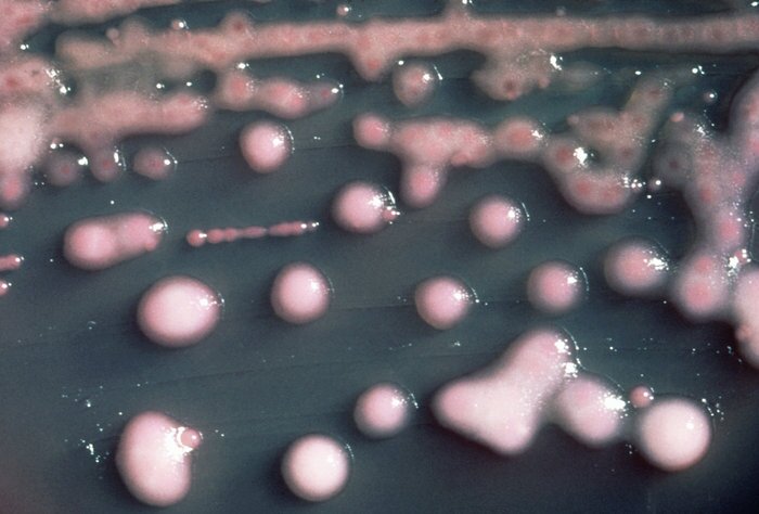 One form of carbapenem-resistant bacteria seen in culture. CRE bacteria are blamed for 600 deaths a year in the U.S. and can withstand treatment by virtually every kind of antibiotic.