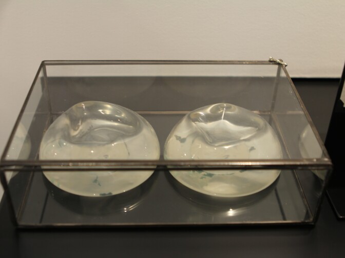 Breast implants that were removed after a breakup sit on display at the Museum of Broken Relationships in Los Angeles, Calif. 