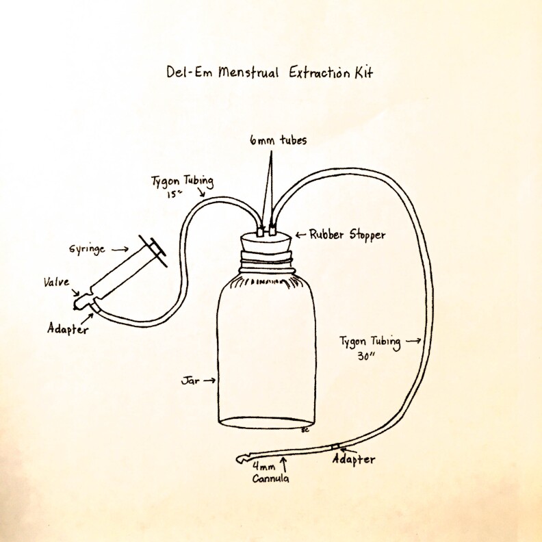 A diagram of a Del-Em kit, developed by Lorraine Rothman