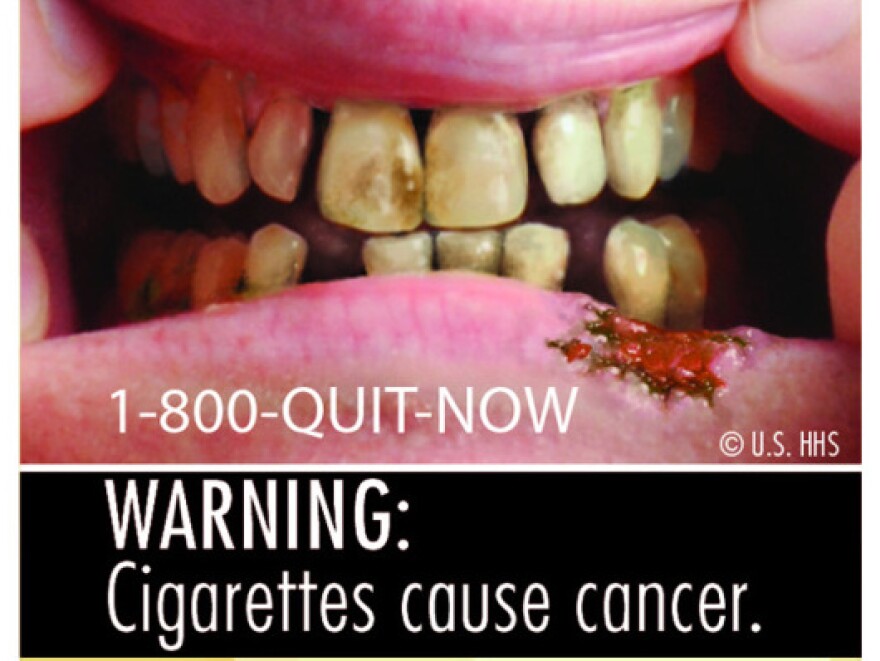 One of the nine new warning labels that will be featured on cigarette packs next year.