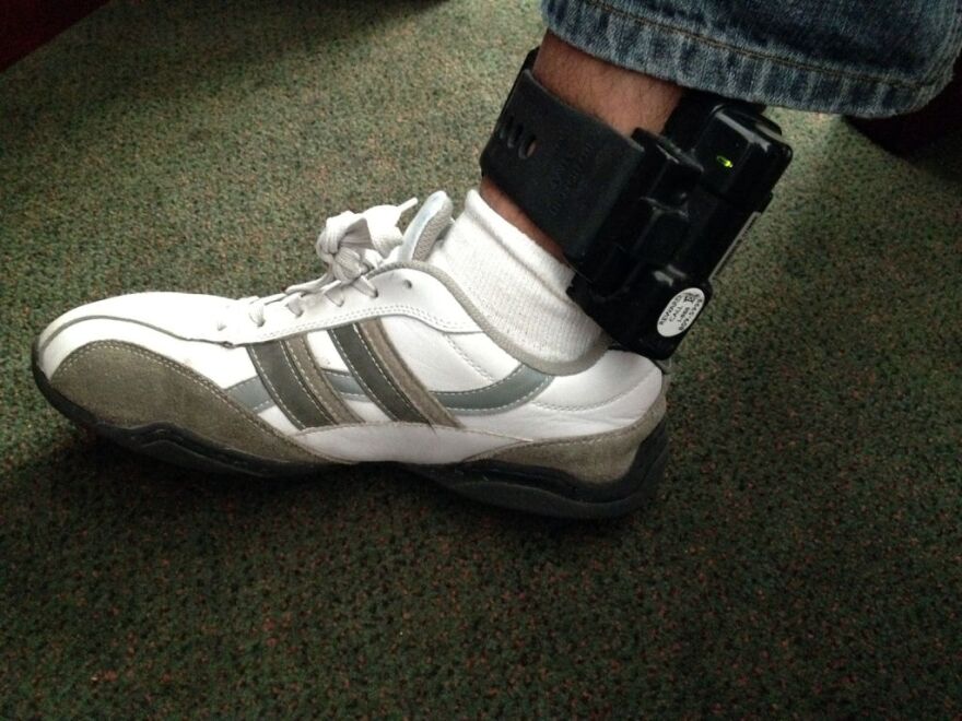 Oscar Carrillo wearing his ankle monitoring bracelet, April 6, 2012.